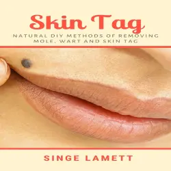 Cover - Skin Tag - Skin Tag - Natural DIY Methods of removing Mole, Wart and Skin Tag